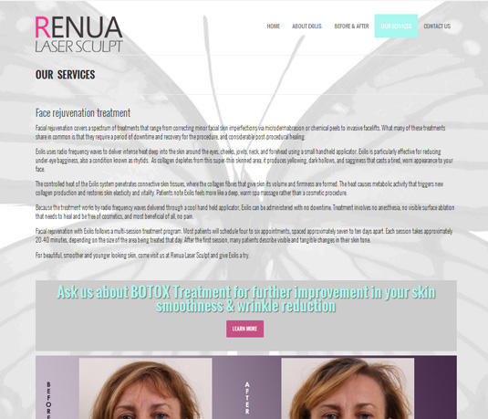 renua4